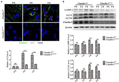 Claudin-5 Affects Endothelial Autophagy in Response to Early Hypoxia